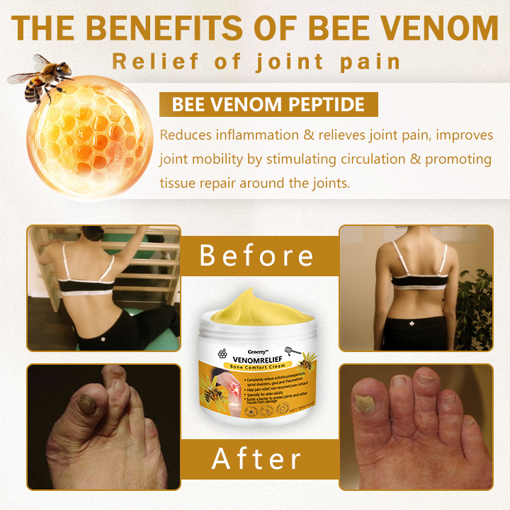 Ceoerty™ VenomRelief Bone Comfort Cream