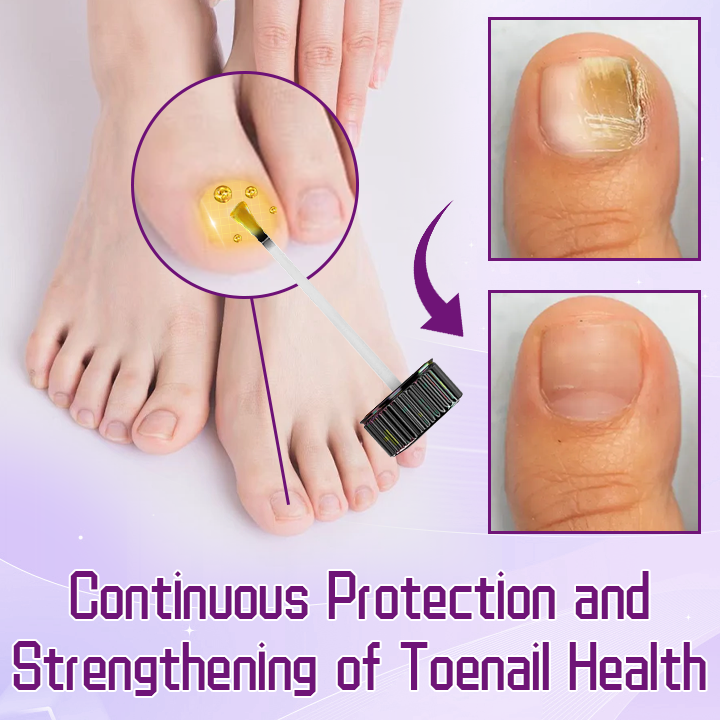 Ceoerty™ FungiShield Bee Venom Toenail Serum