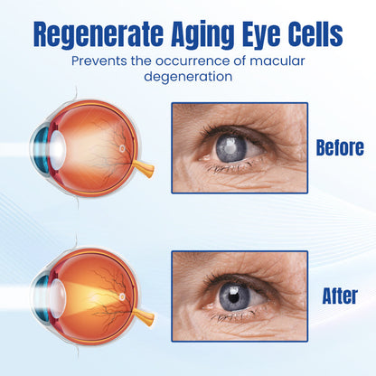 Ceoerty™ OptiRenew Eye Treatment Drops