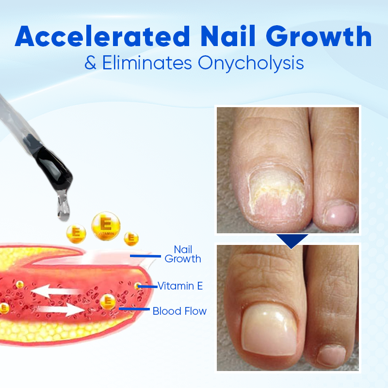 Biancat™ OnyxoGuard Nail Growth and Repair Serum