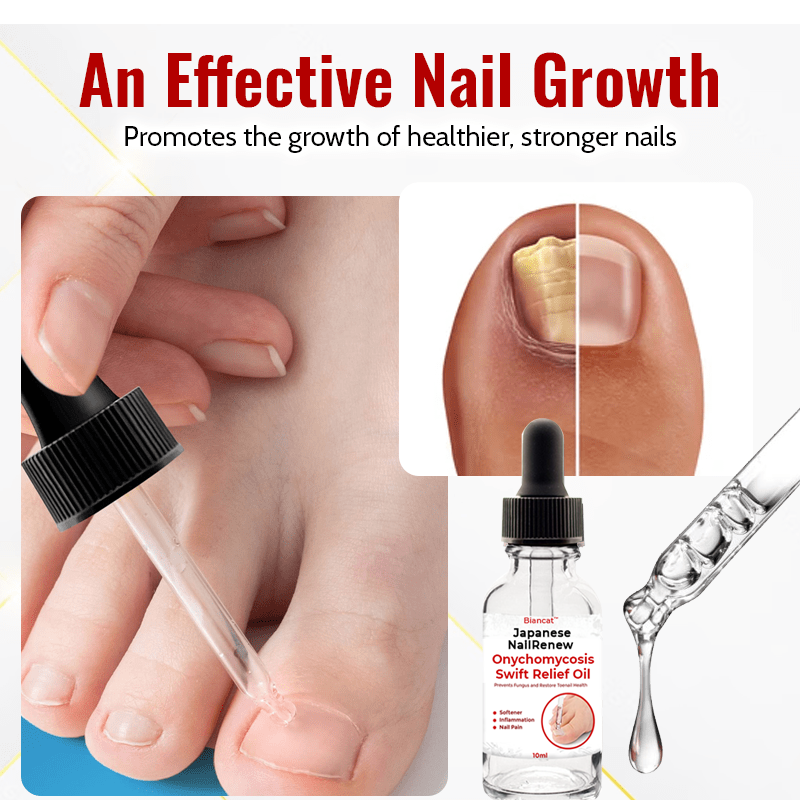 Biancat™ Japanese NailRenew Onychomycosis Rapid Relief Oil