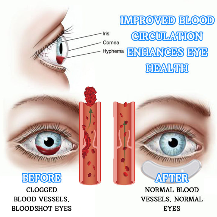 Biancat™ VisionPro Microcurrent Heated Ocular Vitality Device