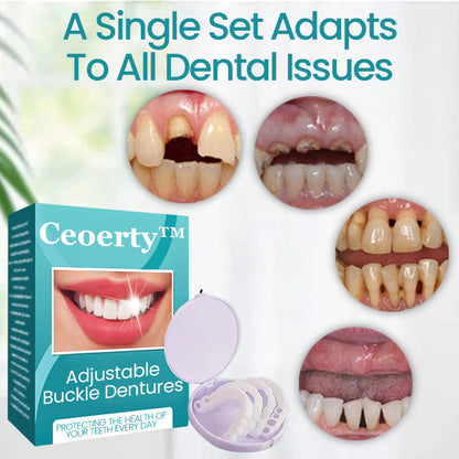 Ceoerty™ Adjustable Buckle Dentures